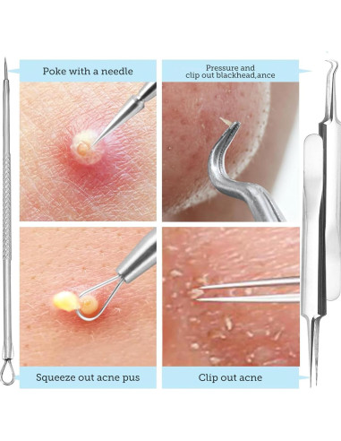 Kit de Herramientas para Remover Puntos Negros Pumwoy 9 PCS