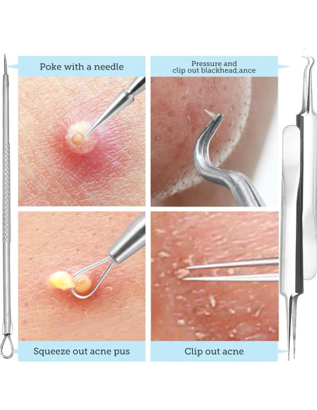 Kit de Herramientas para Remover Puntos Negros Pumwoy 9 PCS