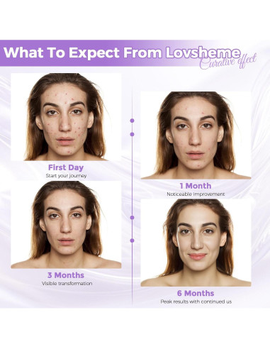 Máscara de Luz LED Lovsheme para Rejuvenecimiento Facial