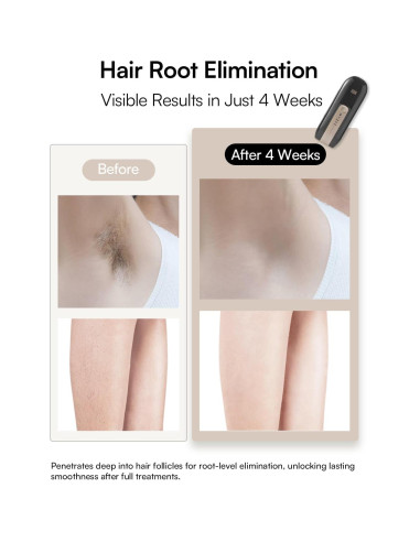 Depilador Láser INIA Fond para Cuerpo y Cara, 5 Niveles