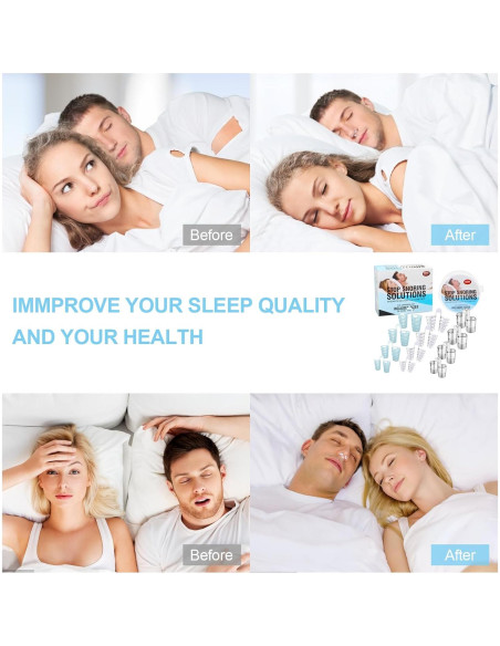 Dilatador Nasal Reutilizable MYMULIKE 4 Tamaños Antisnoring