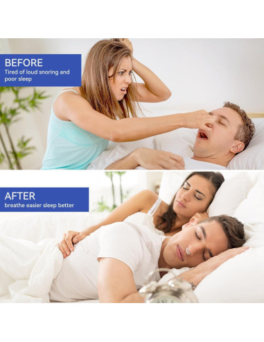 Clip Nasal Anti Ronquidos Anngola - 10 Paquetes Efectivos