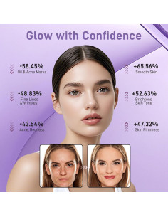 Máscara Facial LED Lovsheme - Terapia de Luz Roja para Piel 2