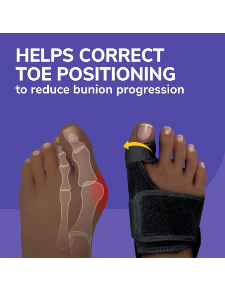 Corrector de Juanetes Dr. Scholl's con Férula de Gel - Alivio Dolor