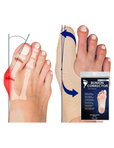 Corrector de Juanetes Bunion Bootie Unisex Pie Izquierdo