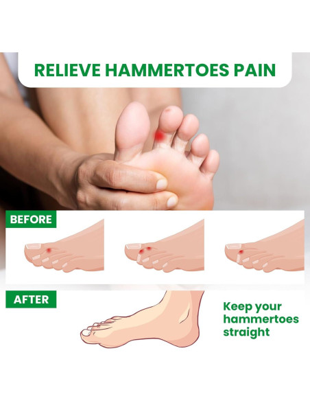 Corrector de Dedo en Martillo Bukihome - 6 Enderezadores Medianos