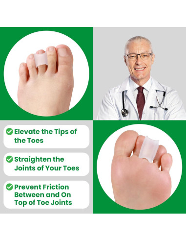 Corrector de Dedo en Martillo Bukihome - 6 Enderezadores Medianos