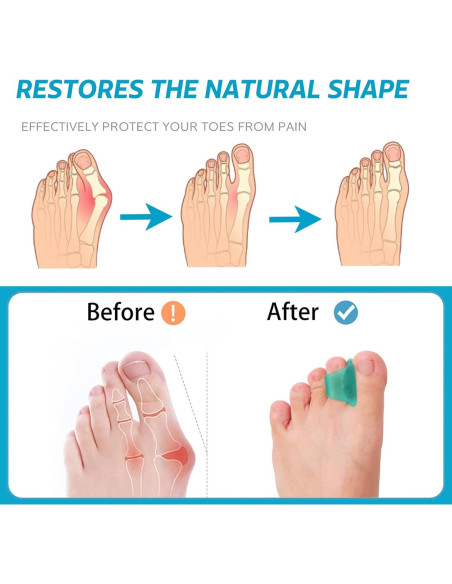 Corrector de Dedo en Martillo Nolimvita - Paquete de 6 Pequeño