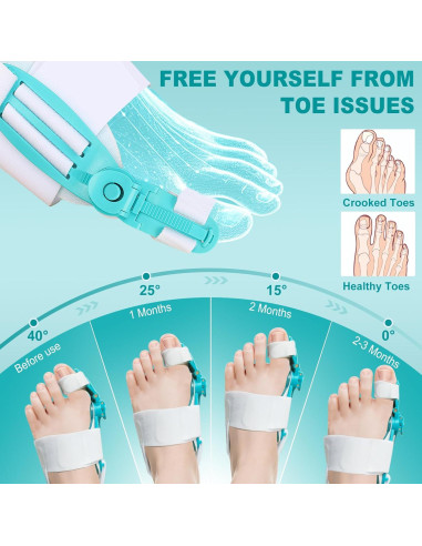 Corrector de Juanetes Ajustable LTEVXZI - 2 Piezas para Alivio