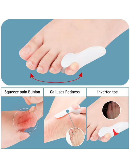 Separador de Dedo Meñique DYKOOK 6 Piezas Gel Alivio Dolor