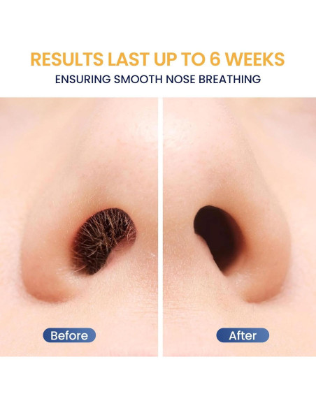 Kit de Cera para Nariz y Oídos Suerbeaty 100g USB Calentamiento