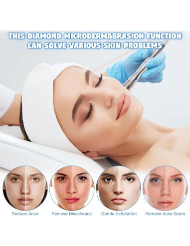 Máquina de Microdermoabrasión 2 en 1 Beauty Star - Limpieza Facial Profesional