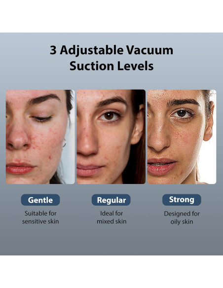 Removedor de Puntos Negros ViQure Hydrafacial 5 en 1