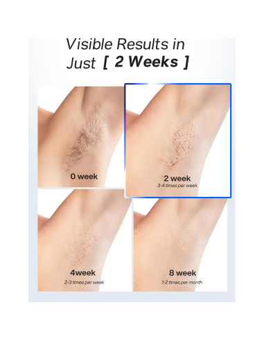 Depilador Láser IPL Blex para Hombres y Mujeres, Indoloro, 21J