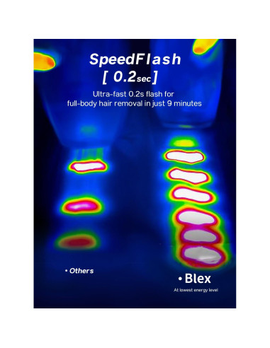 Depilador Láser IPL Blex para Hombres y Mujeres, Indoloro, 21J