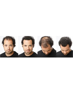 Fibras para Cabello Ustar Castaño Rojizo 27.5g - Calidad Toppik 2