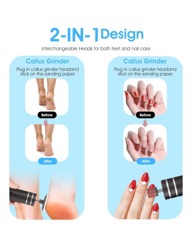 Removedor de Callos Eléctrico ADVEZO 2-en-1 USB Negro