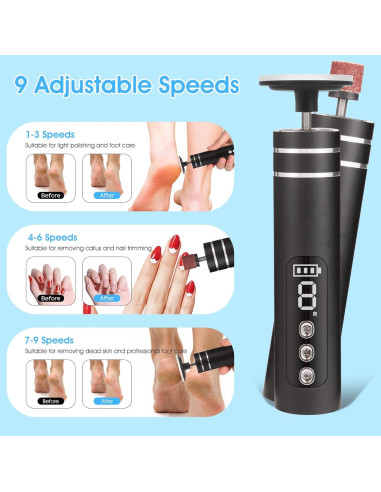 Removedor de Callos Eléctrico ADVEZO 2-en-1 USB Negro