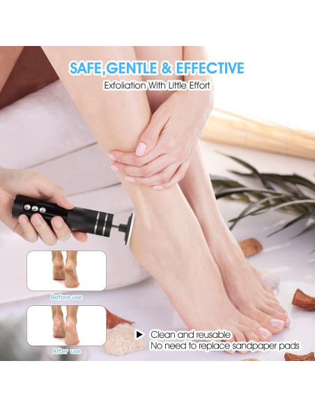 Removedor de Callos Eléctrico ADVEZO 2-en-1 USB Negro