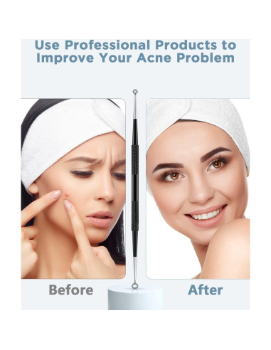 Kit Removedor de Puntos Negros TAYTHI - 5 Herramientas Acero Inoxidable