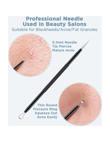 Kit Removedor de Puntos Negros TAYTHI - 5 Herramientas Acero Inoxidable
