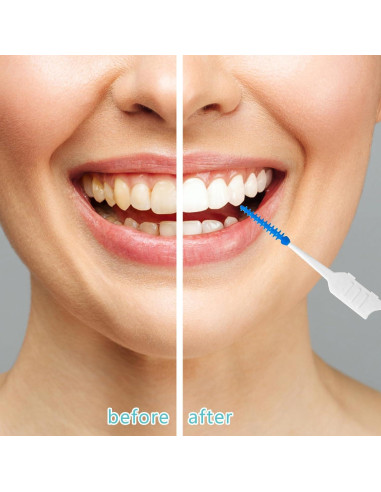 250 Palillos de Hilo Dental Lanjue Azul y Verde con Estuche