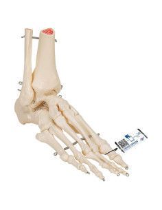 Esqueleto de pie 3B Scientific A31 con tibia y fíbula