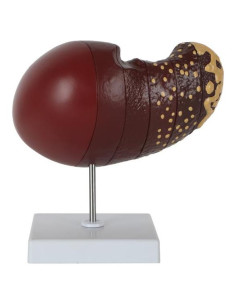 Modelo de Hígado Humano a Tamaño Real Axis Scientific 6 Etapas