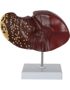 Modelo de Hígado Humano a Tamaño Real Axis Scientific 6 Etapas 2