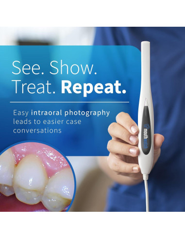 Cámara Intraoral Digital MouthWatch 1 - Imágenes Claras y Rápidas