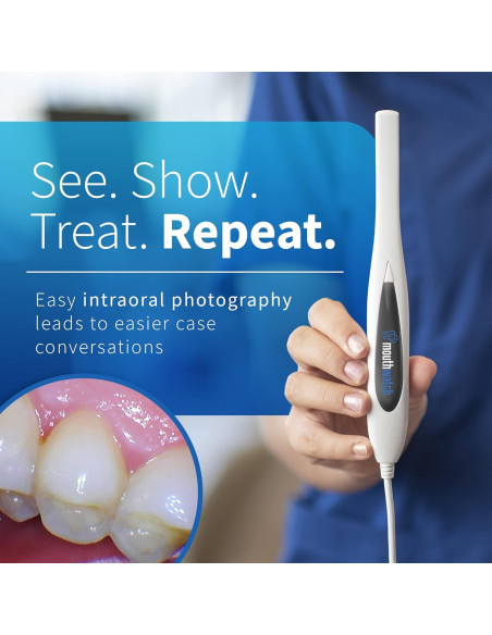Cámara Intraoral Digital MouthWatch 1 - Imágenes Claras y Rápidas