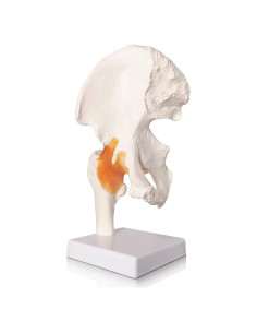 Modelo de Articulación de Cadera Evotech 3D Real con Base