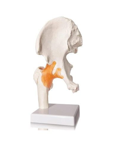 Modelo de Articulación de Cadera Evotech 3D Real con Base