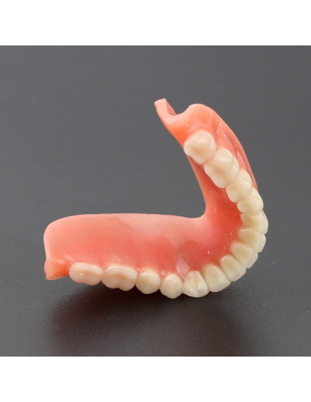 Modelo Dental Typodont M6002 con Sobredentadura y 2 Implantes