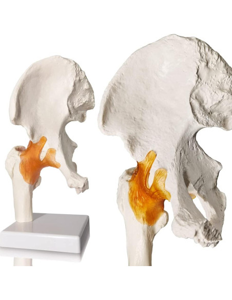 Modelo de Articulación de Cadera Evotech 3D Real con Base