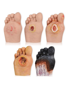 Modelo de Cuidado del Pie Diabético 5 Pcs Ultrassist - Simulador Grado 1-5