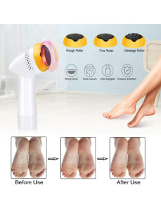 Removedor de Callos Eléctrico SUYOOULIN FL-001-GL 3000 RPM 2