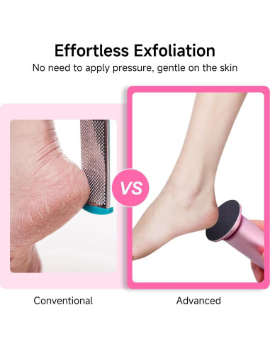 Removedor de Callos Eléctrico iRnergy con 60 Discos de Lija