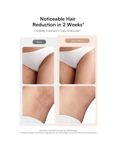 Eliminador de Vello Láser INIA HAUTE Pro IPL Indoloro 308g 2