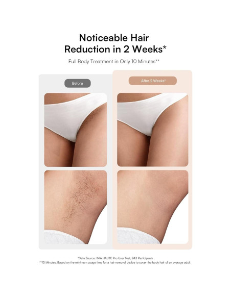 Eliminador de Vello Láser INIA HAUTE Pro IPL Indoloro 308g