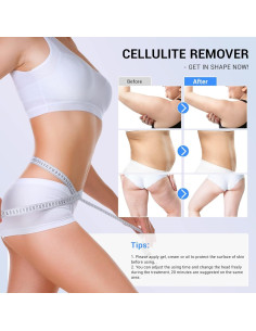 Masajeador de Celulitis SonGxu G05-0115-2 Radiofrecuencia 2