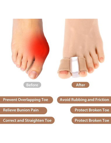 Separadores de Dedos de Gel Wanmu para Juanetes - 4 Pcs