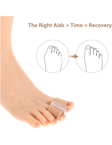 Separadores de Dedos de Gel Wanmu para Juanetes - 4 Pcs