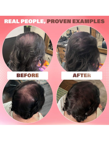 Fibras para Cabello Fino Rejuvenate - Marrón Medio 27.5g