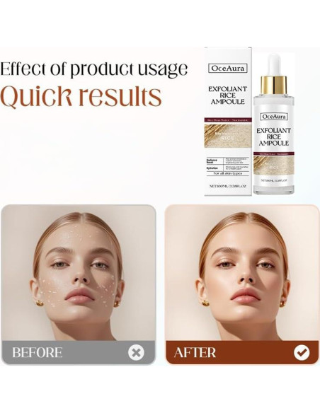 Ampoule Exfoliante Suave Axnzp 100 ml Arroz Negro y Blanco