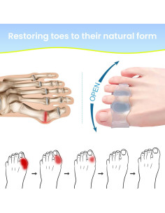 Corrector de Juanetes Ajustable XREKNOi Modelo 02 para Alivio 2