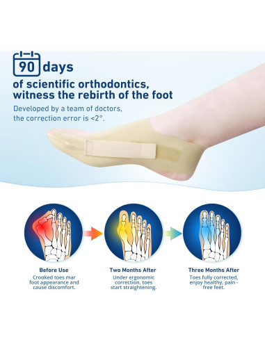 Corrector de Juanetes RUSHFORWARD Ajustable Unisex - Alivio Hallux Valgus