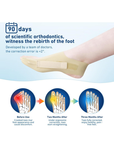 Corrector de Juanetes RUSHFORWARD Ajustable Unisex - Alivio Hallux Valgus