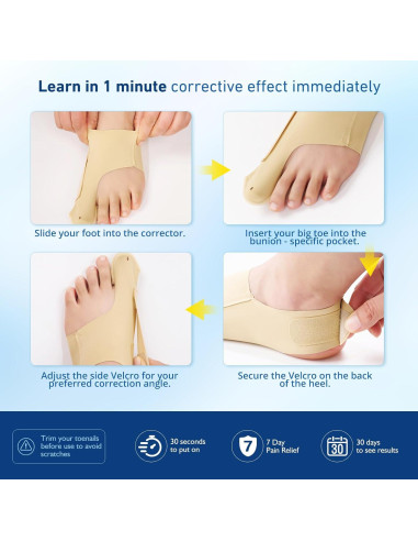 Corrector de Juanetes RUSHFORWARD Ajustable Unisex - Alivio Hallux Valgus