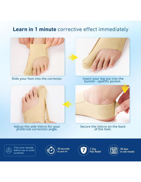 Corrector de Juanetes RUSHFORWARD Ajustable Unisex - Alivio Hallux Valgus